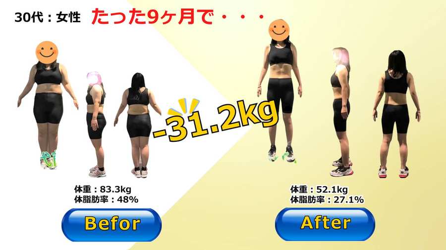 30代女性が9ヶ月で体重83.3kgから52.1kgへマイナス31.2kgを達成したビフォーアフター写真