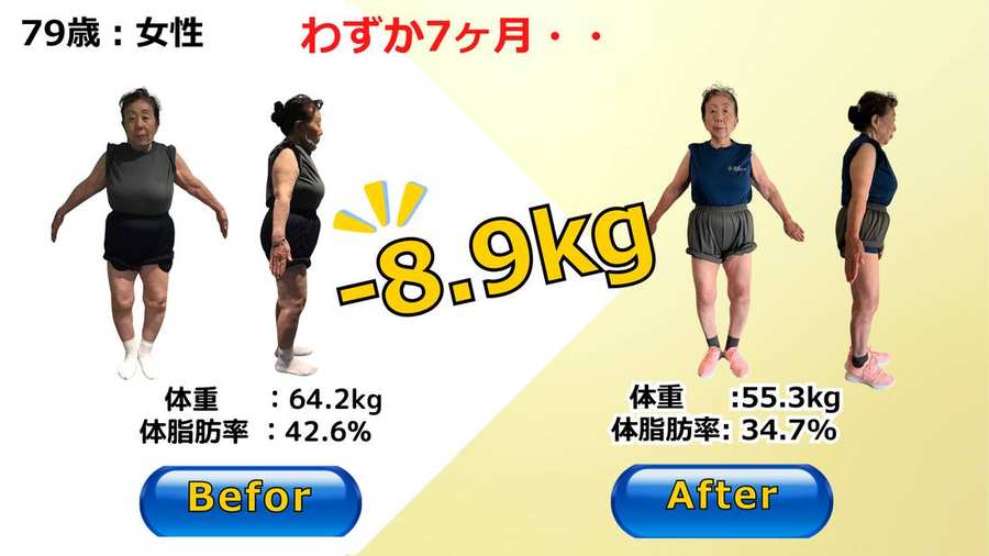 79歳女性が7ヶ月で体重マイナス8.9kg、体脂肪率42.6%から34.7%を達成したビフォーアフター写真