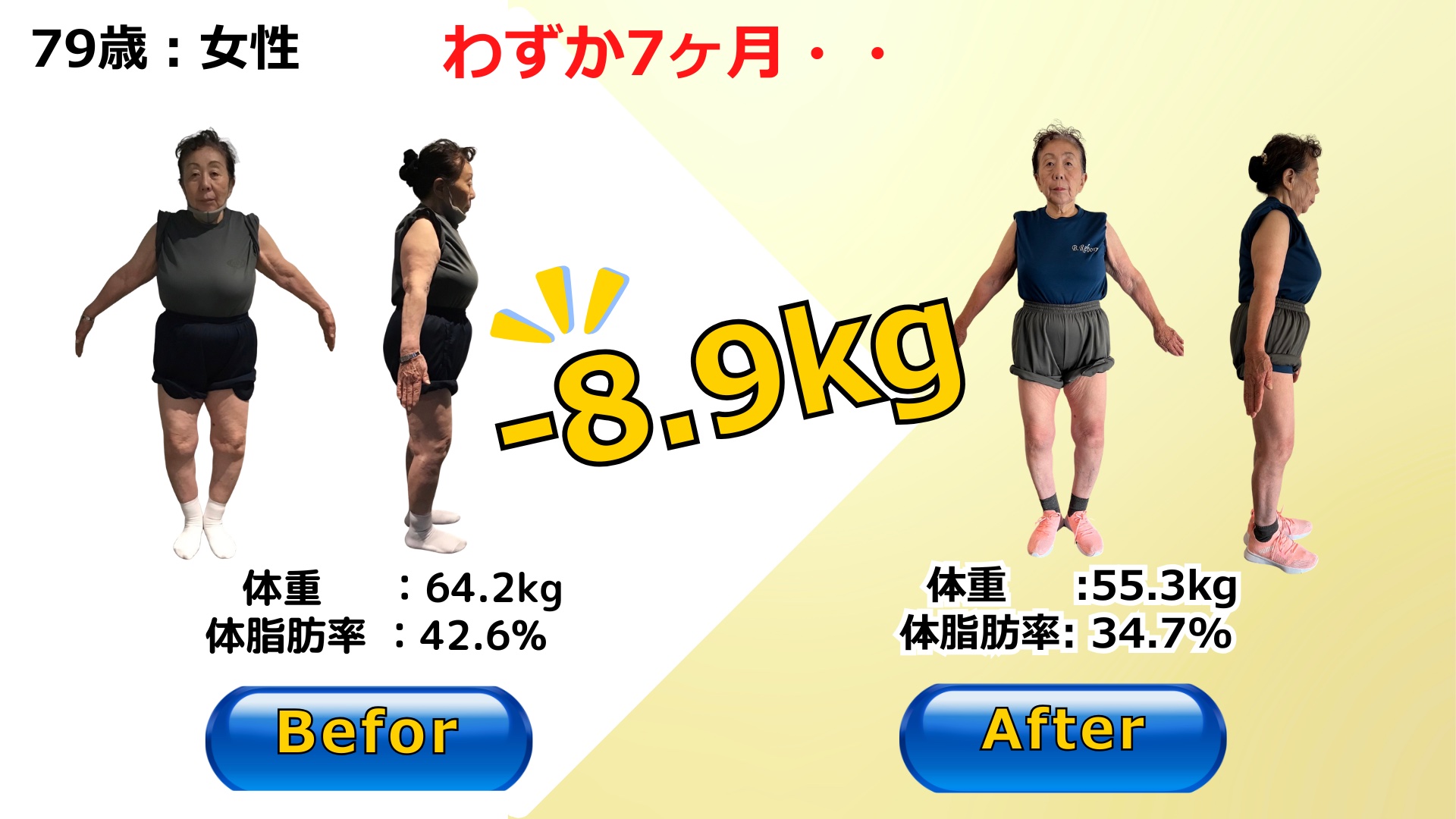 79歳のお客様のビフォーアフター